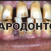 мявин